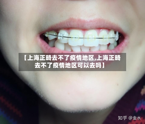 【上海正畸去不了疫情地区,上海正畸去不了疫情地区可以去吗】